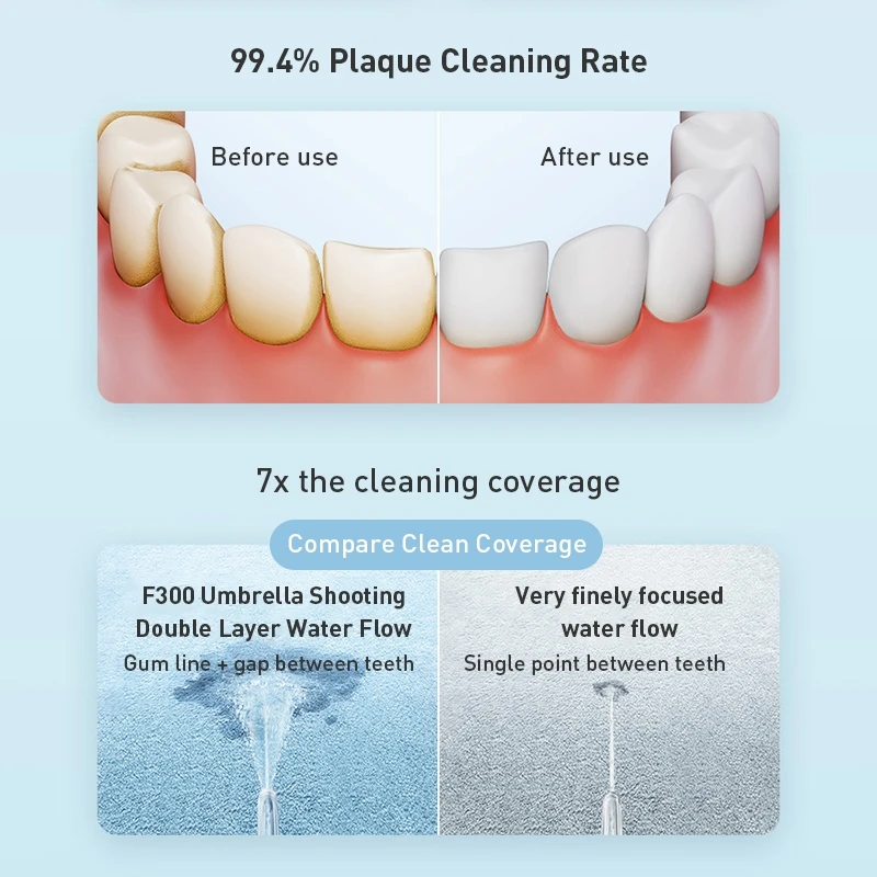 เครื่องฉีดน้ำทำความสะอาดช่องปา - Oral Irrigator Flosser บทวิจารณ์และราคา
